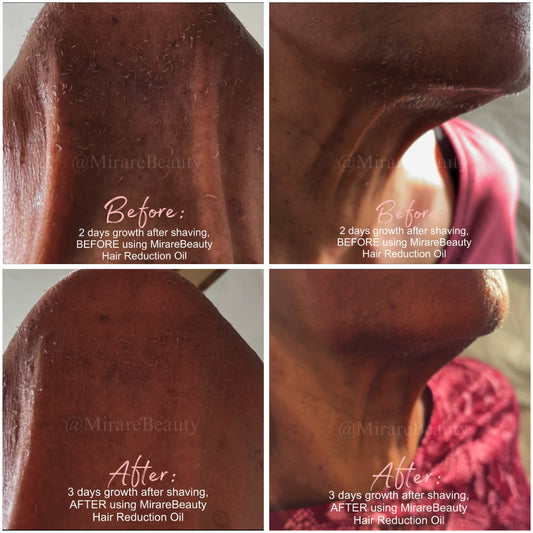 100% All Natural Hair Reduction Oil